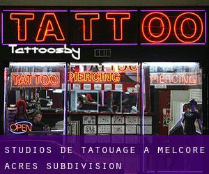 Studios de Tatouage à Melcore Acres Subdivision