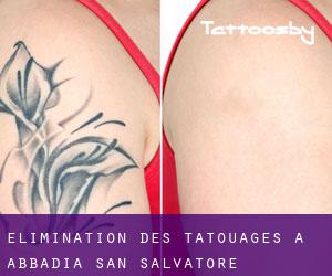 Élimination des tatouages à Abbadia San Salvatore