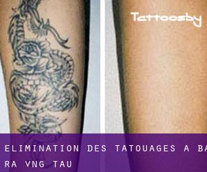 Élimination des tatouages à Bà Rịa-Vũng Tàu