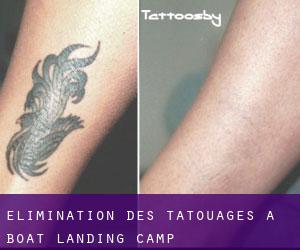 Élimination des tatouages à Boat Landing Camp