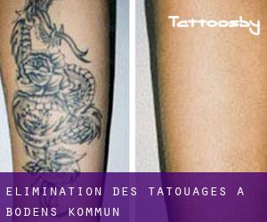 Élimination des tatouages à Bodens Kommun