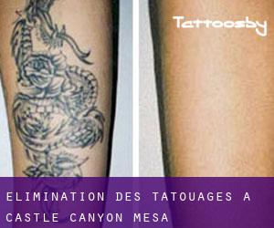 Élimination des tatouages à Castle Canyon Mesa