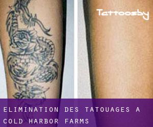 Élimination des tatouages à Cold Harbor Farms