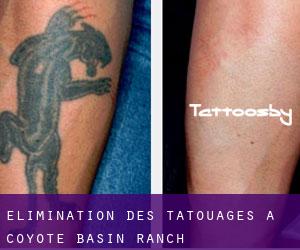 Élimination des tatouages à Coyote Basin Ranch