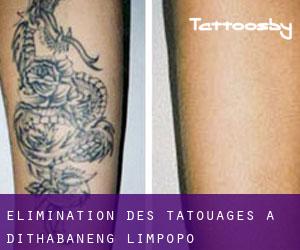 Élimination des tatouages à Dithabaneng (Limpopo)