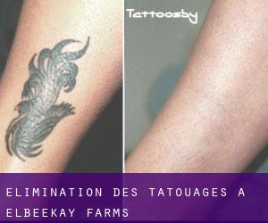 Élimination des tatouages à Elbeekay Farms