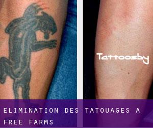 Élimination des tatouages à Free Farms