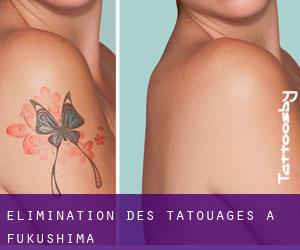Élimination des tatouages à Fukushima