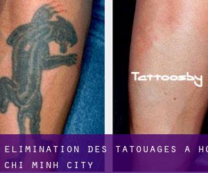 Élimination des tatouages à Ho Chi Minh City