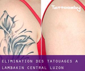Élimination des tatouages à Lambakin (Central Luzon)