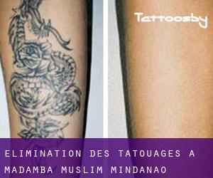 Élimination des tatouages à Madamba (Muslim Mindanao)