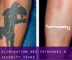 Élimination des tatouages à Security (Texas)