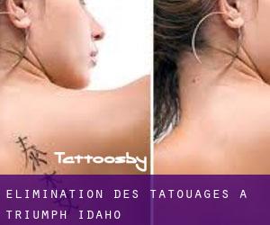 Élimination des tatouages à Triumph (Idaho)