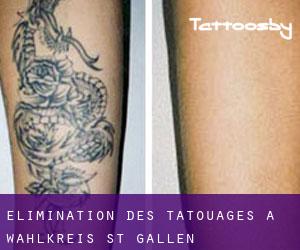 Élimination des tatouages à Wahlkreis St. Gallen